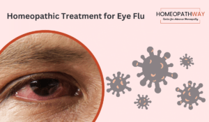 Homeopathic Treatment for Eye Flu